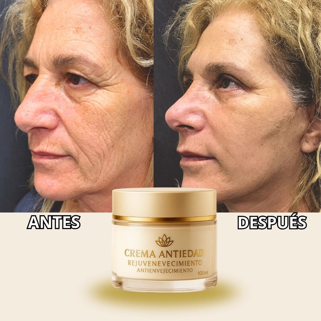 COMPRA 1 Y LLEVA 2 - Crema Rejuvenecedora y Anti-Envejecimiento - PAGUE AL RECIBIR