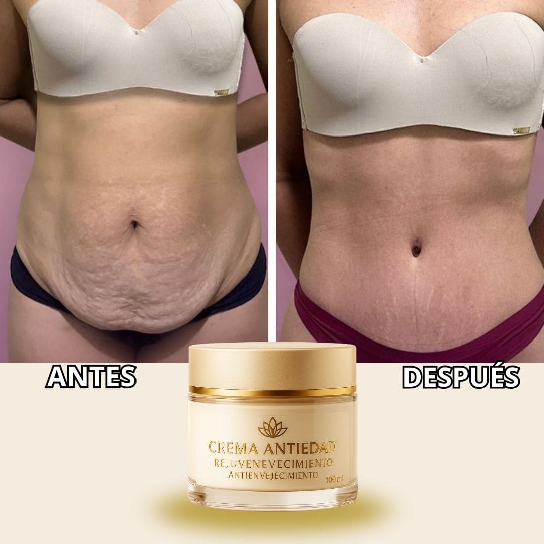 COMPRA 1 Y LLEVA 2 - Crema Rejuvenecedora y Anti-Envejecimiento - PAGUE AL RECIBIR
