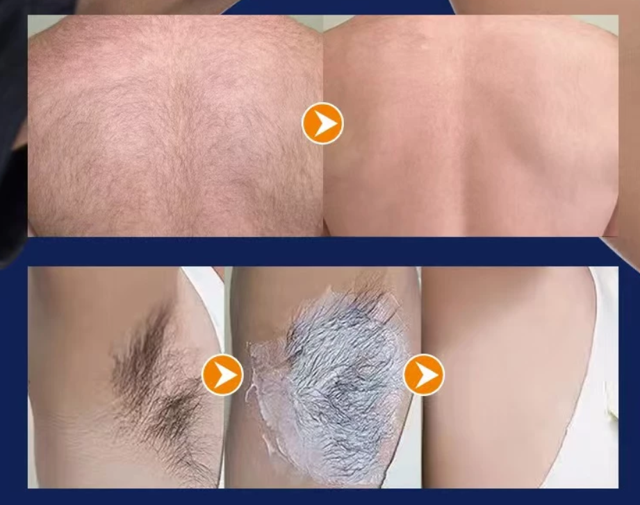 Crema Depilatoria Accion Rapida Sadoer    -    PAGUE AL RECIBIR